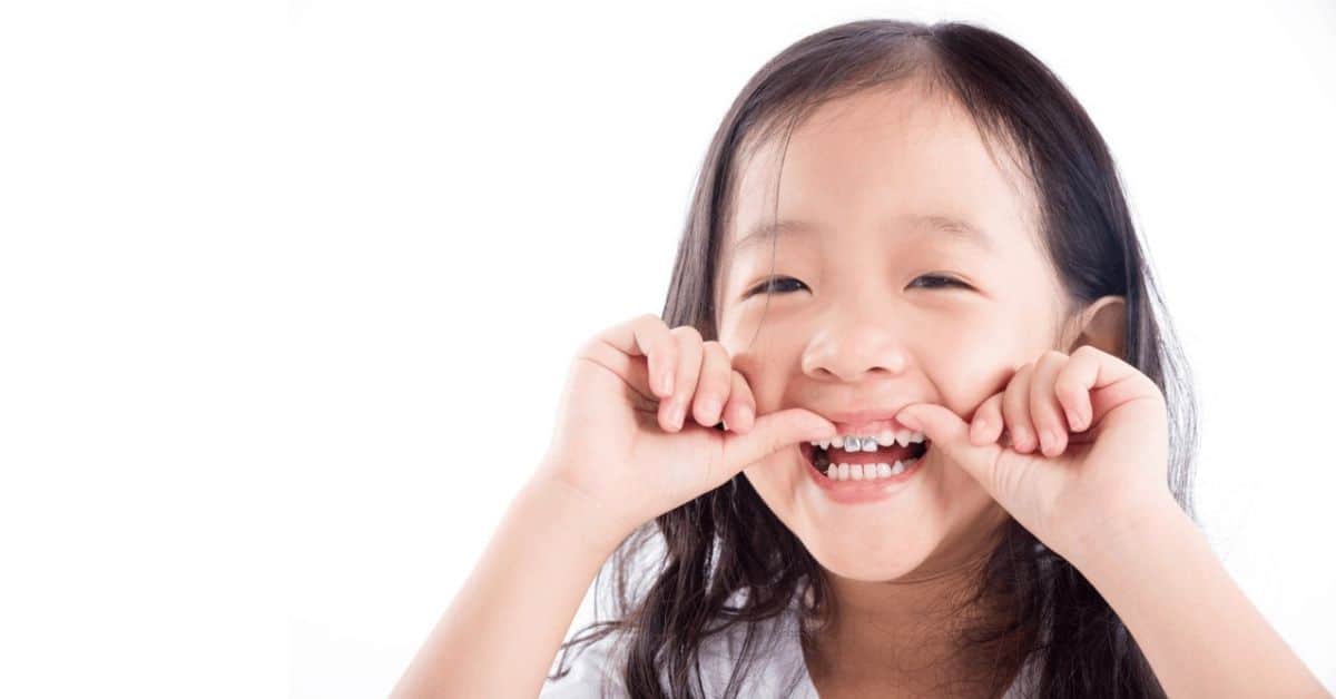ครอบฟันน้ำนม ครอบฟันเด็ก ครอบฟันเหล็ก การครอบฟันน้ำนม หรือ การครอบฟันเด็ก คืออะไร?