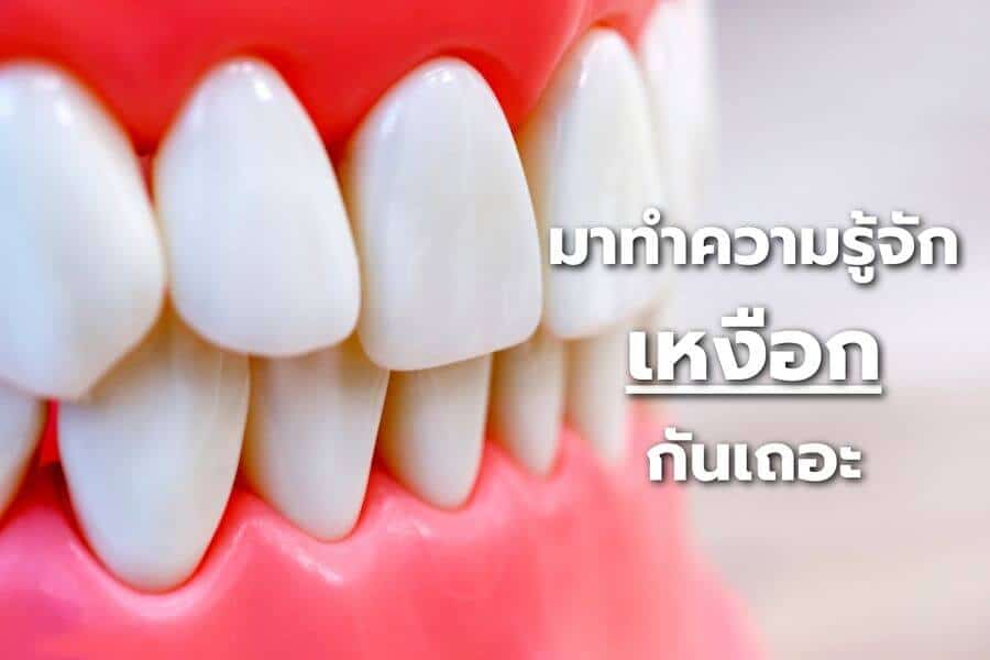 เหงือกบวม เหงือกอักเสบ สาเหตุและวิธีรักษา - คลินิกทันตกรรม Smiledc