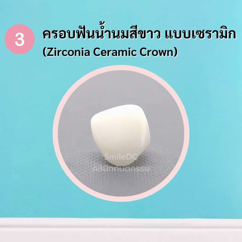 ครอบฟันน้ำนมสีขาว แบบเซรามิก Zirconia Ceramic Crown
