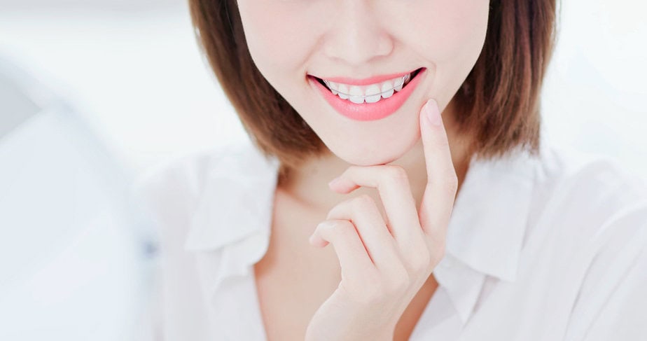 ผู้หญิงยิ้มสดใสใส่รีเทนเนอร์ที่ฟัน