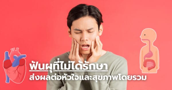 ฟันผุที่ไม่ได้รักษาอาจส่งผลต่อหัวใจและสุขภาพโดยรวมได้