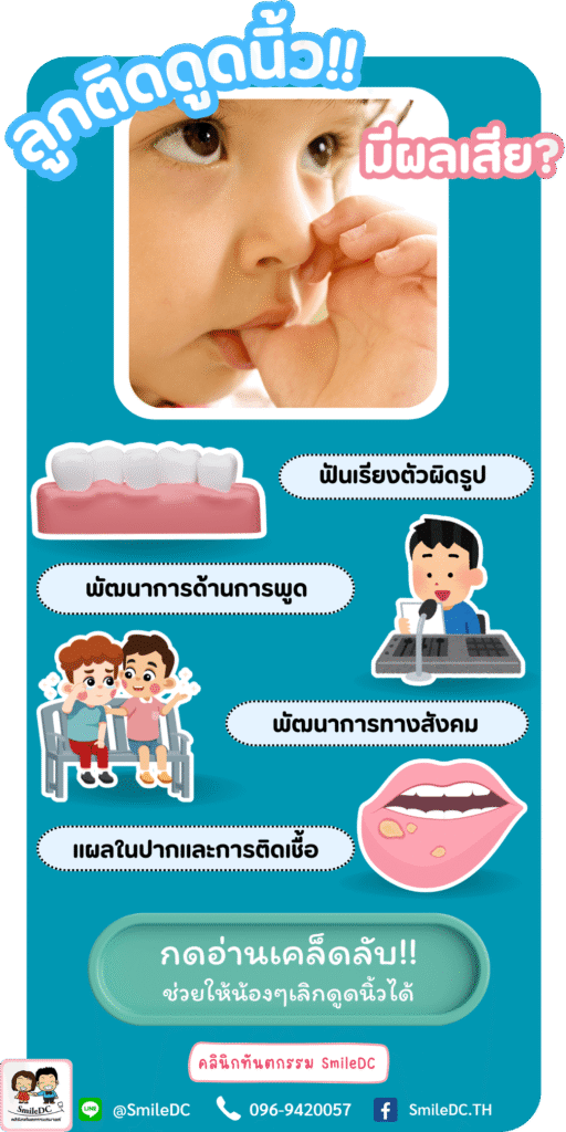ลูกติดดูดนิ้ว มีผลเสียมั๊ย?